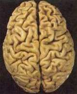 brain.jpg