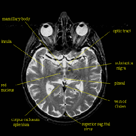 brain